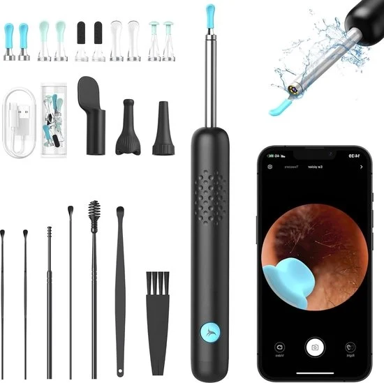 Otoscoop con camera 360° a grande angolo 6 LED - Illuminazione IP67 impermeabile Pulitore e rimuovitore di cerume per iPhone, iPad e smartphone Android